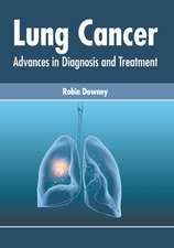 Lung Cancer: Advances in Diagnosis and Treatment