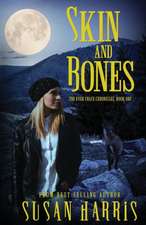 Skin and Bones: The Ever Chace Chronicles, Book One