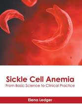 Sickle Cell Anemia: From Basic Science to Clinical Practice