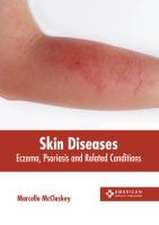 Skin Diseases: Eczema, Psoriasis and Related Conditions