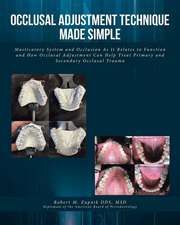 Occlusal Adjustment Technique Made Simple