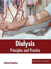 Dialysis: Principles and Practice