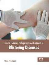 Clinical Features, Pathogenesis and Treatment of Blistering Diseases