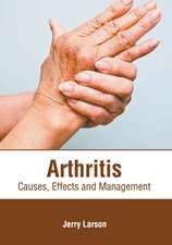 Arthritis: Causes, Effects and Management