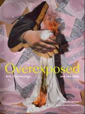 Overexposed