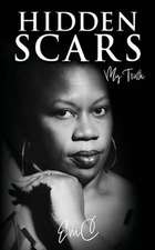 Hidden Scars: My Truth