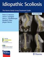 Idiopathic Scoliosis – The Harms Study Group Treatment Guide: The Harms Study Group Treatment Guide