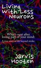 Living With Less Neurons