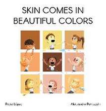 Skin comes in beautiful colors