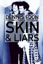 Skin & Liars