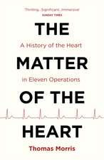 Morris, T: Matter of the Heart: A History of the Heart in Eleven Operations