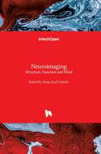 Neuroimaging