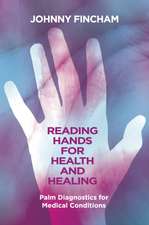 Palm Reading for Holistic Health