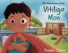 The Adventures of The Vitiligo Man