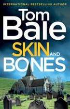 Skin and Bones
