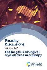 Challenges in Biological Cryo Electron Microscopy