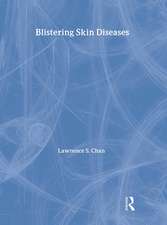 Blistering Skin Diseases