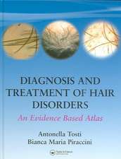 Diagnosis and Treatment of Hair Disorders: An Evidence Based Atlas