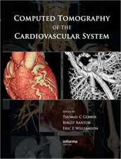 Computed Tomography of the Cardiovascular System