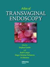 Atlas of Transvaginal Endoscopy