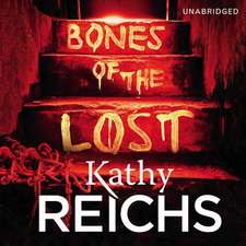 Reichs, K: Bones of the Lost