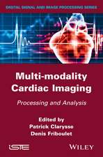 Multi–modality Cardiac Imaging – Processing and Analysis