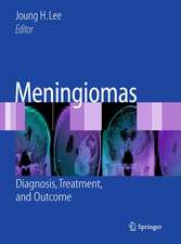 Meningiomas: Diagnosis, Treatment, and Outcome