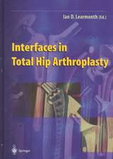 Interfaces in Total Hip Arthroplasty