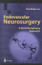 Endovascular Neurosurgery: A Multidisciplinary Approach