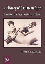 History of Caesarean Birth: From Maternal Death to Maternal Choice