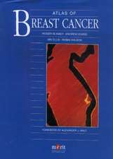 Atlas of Breast Cancer