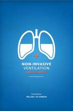 Non-Invasive Ventilation Made Simple