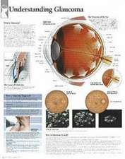 Understanding Menopause Chart: Wall Chart