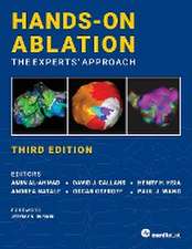 Hands-On Ablation, The Experts' Approach, Third Edition