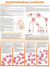 Understanding Leukemia Anatomical Chart