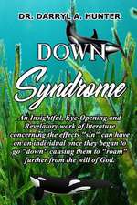 Down Syndrome