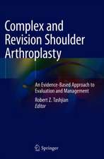 Complex and Revision Shoulder Arthroplasty 