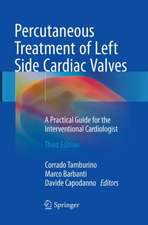 Percutaneous Treatment of Left Side Cardiac Valves: A Practical Guide for the Interventional Cardiologist