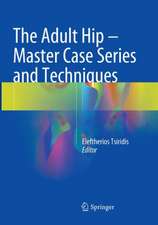 The Adult Hip - Master Case Series and Techniques