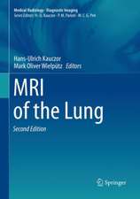 MRI of the Lung