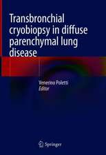 Transbronchial cryobiopsy in diffuse parenchymal lung disease