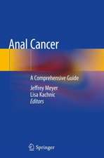 Anal Cancer: A Comprehensive Guide