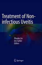 Treatment of Non-infectious Uveitis