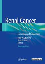 Renal Cancer: Contemporary Management