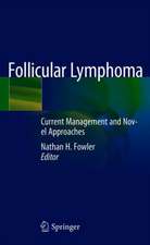 Follicular Lymphoma: Current Management and Novel Approaches