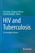 HIV and Tuberculosis