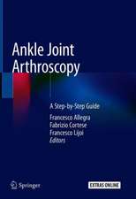 Ankle Joint Arthroscopy: A Step-by-Step Guide