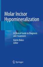 Molar Incisor Hypomineralization: A Clinical Guide to Diagnosis and Treatment