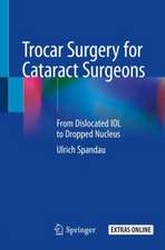 Trocar Surgery for Cataract Surgeons: From Dislocated IOL to Dropped Nucleus