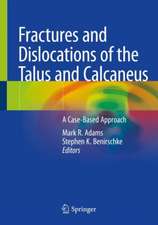 Fractures and Dislocations of the Talus and Calcaneus: A Case-Based Approach